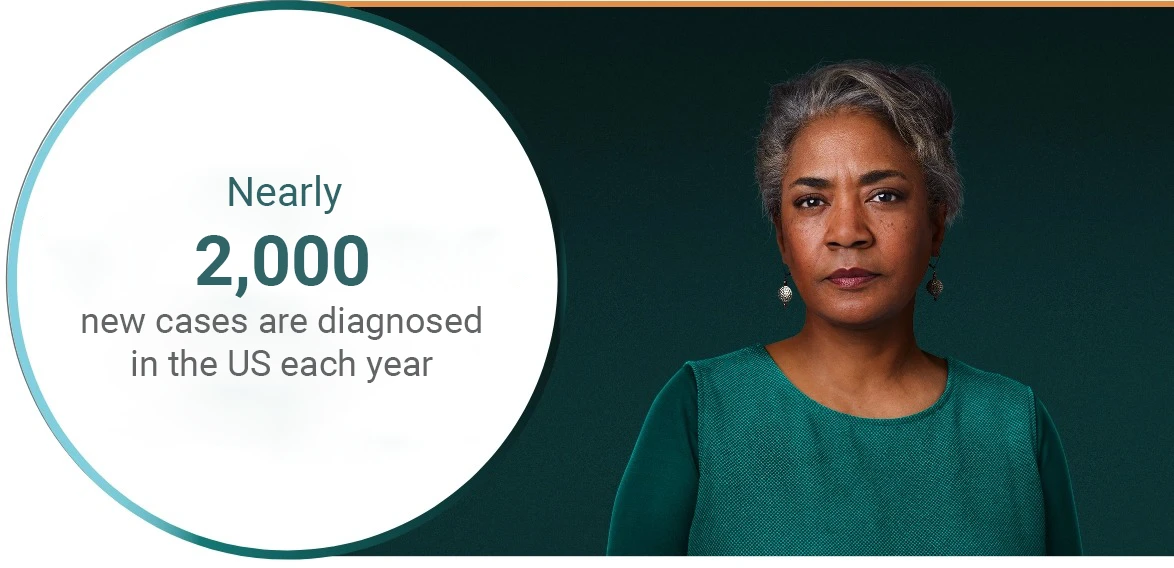 An older woman wearing a deep teal blouse looks intently straight into the camera while this statistic is written overhead: An estimated 1,000-2,000 new cases of LGSOC are diagnosed every year in the United States.